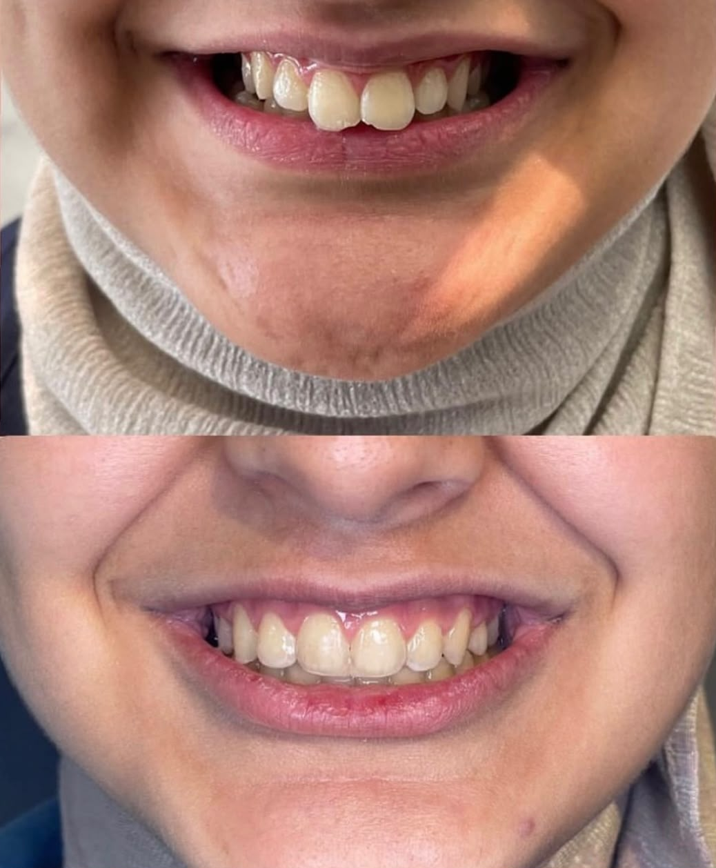 Orthodontie : soin réalisé au cabinet